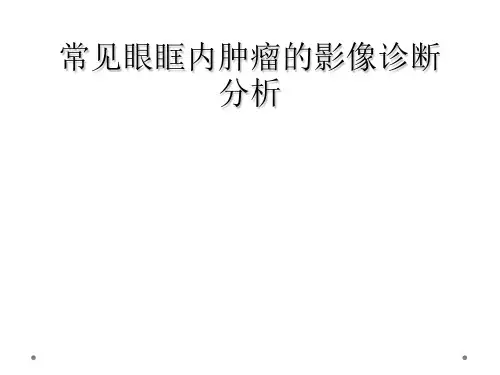 常见眼眶内肿瘤的影像诊断分析