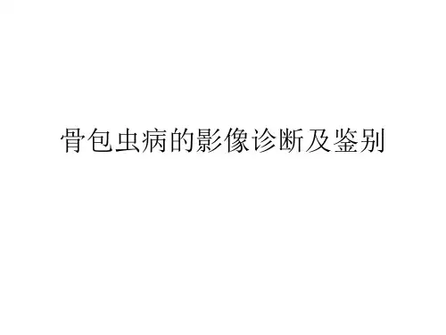 骨包虫病的影像诊断及鉴别