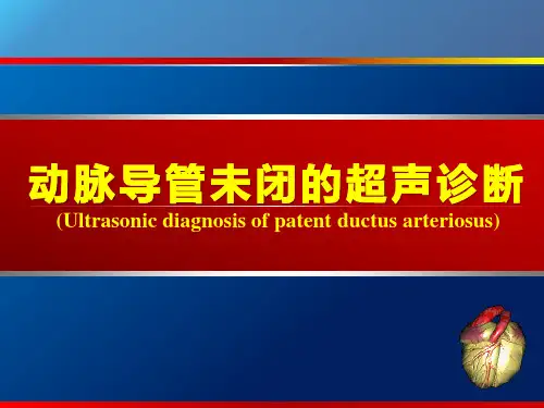 动脉导管未闭、主动脉狭窄超声PPT课件