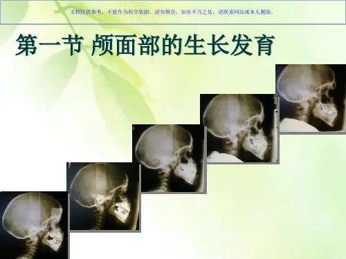 错牙合畸形的发病机制和病因课件