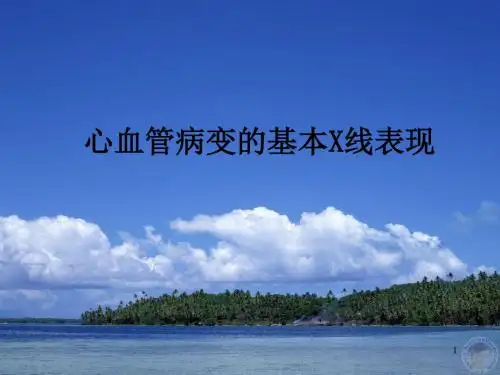 循环系统X线表现PPT幻灯片课件