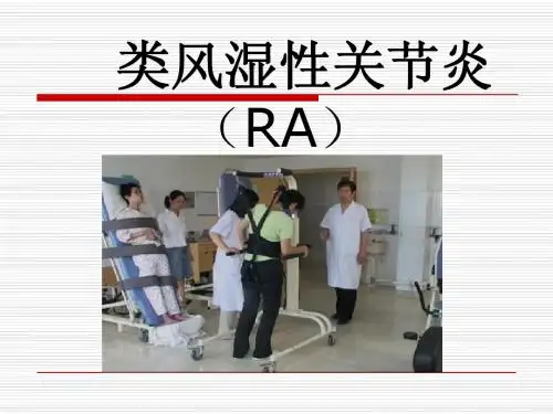类风湿性关节炎