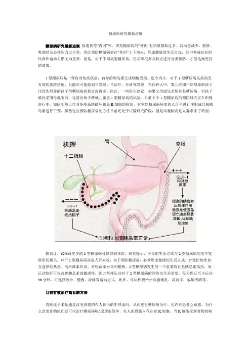 糖尿病研究最新进展