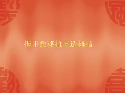踇甲瓣移植再造拇指