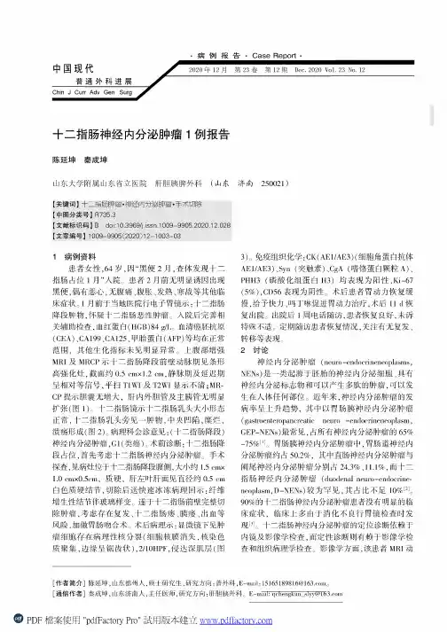 十二指肠神经内分泌肿瘤1例报告