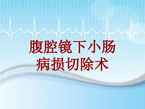 手术讲解模板：腹腔镜下小肠病损切除术