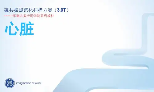 心脏规范化扫描方案