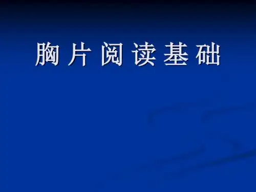 胸片阅读 PPT课件