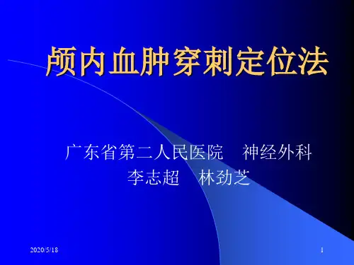 颅内血肿穿刺定位法.