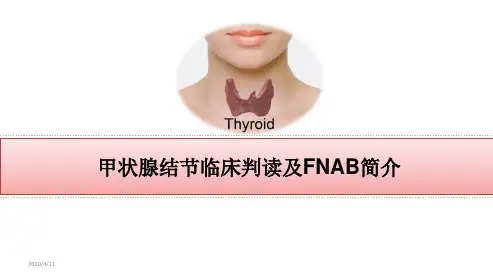 甲状腺结节彩超判读及细针穿刺知识讲解