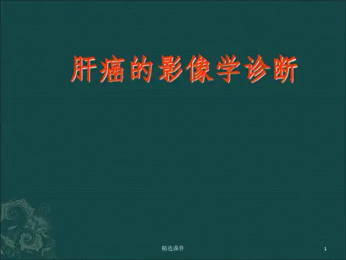 肝癌的影像学诊断