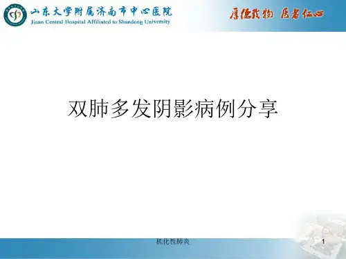 机化性肺炎ppt课件