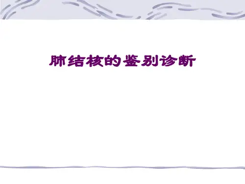 肺结核的鉴别诊断PPT课件