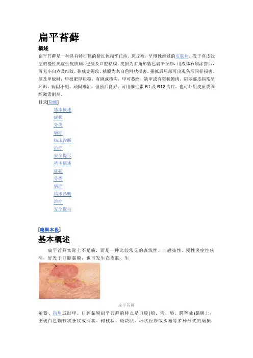 扁平苔藓