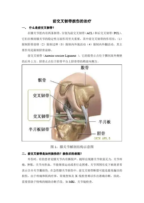 前交叉韧带损伤患者须知