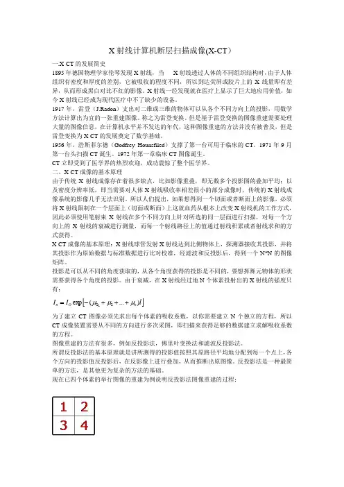 X射线计算机断层扫描成像(X-CT)