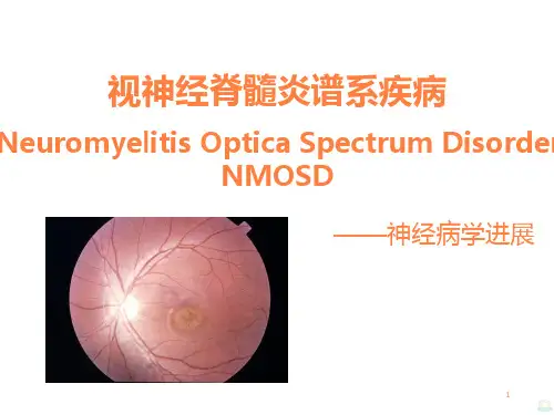 视神经脊髓炎谱系疾病 ppt课件