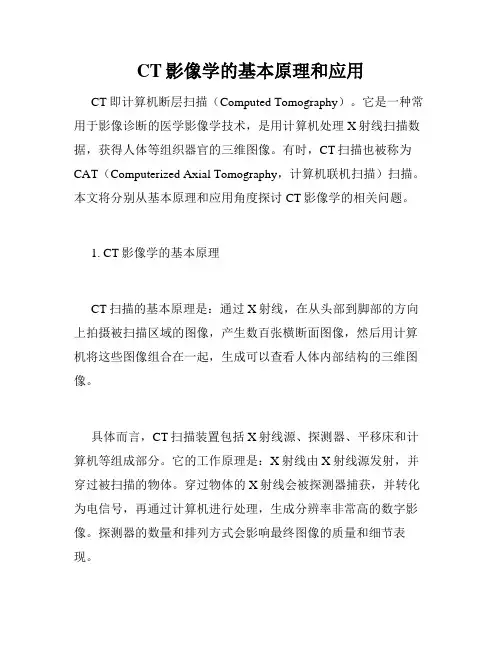 CT影像学的基本原理和应用