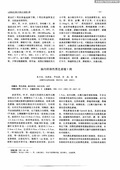 脑内转移性黑色素瘤1例