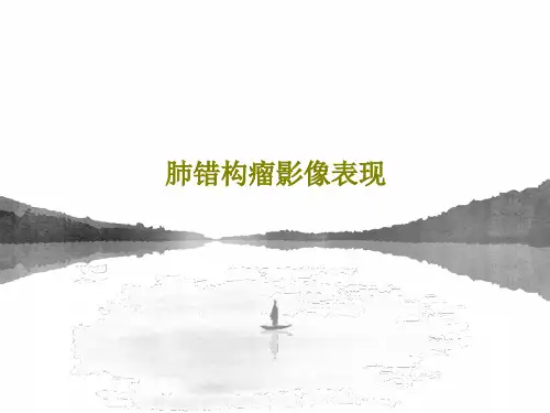 肺错构瘤影像表现共34页