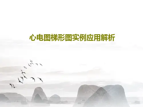 心电图梯形图实例应用解析124页PPT