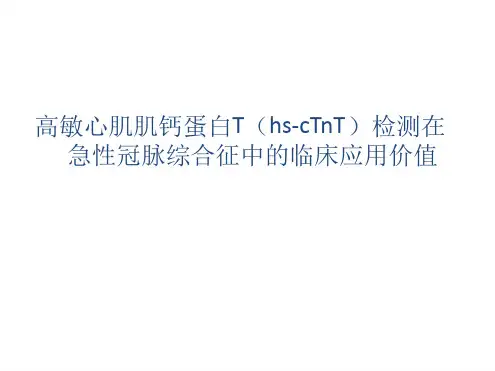 高敏心肌肌钙蛋白T