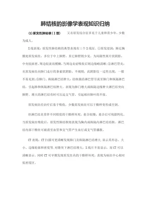 肺结核的影像学表现知识归纳