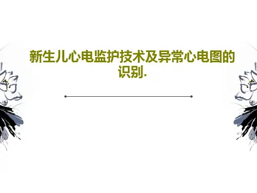新生儿心电监护技术及异常心电图的识别.共59页
