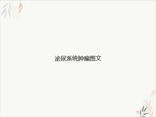 泌尿系统肿瘤图文PPT课件
