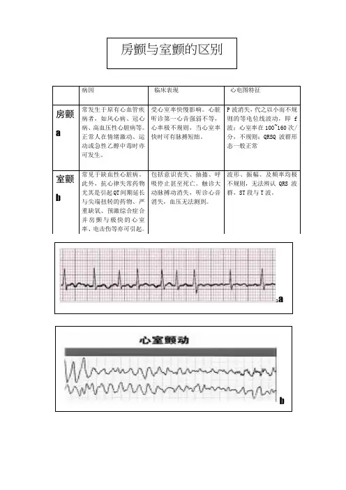 房颤房扑对比