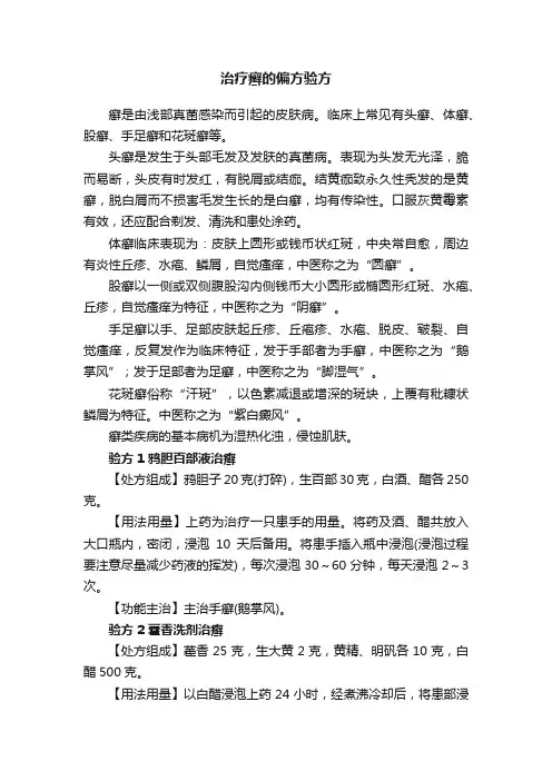 治疗癣的偏方验方