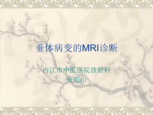 讲座：垂体病变的MRI诊断