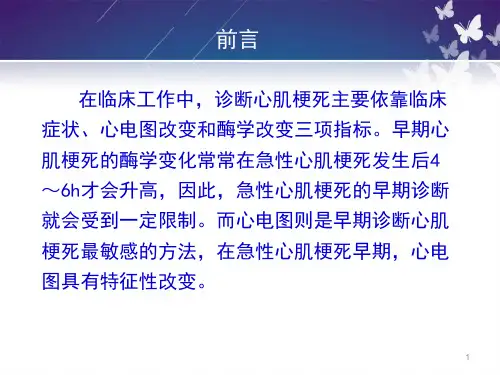 心梗早期心电图分析