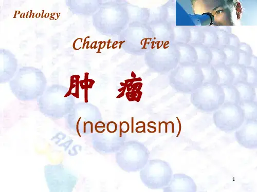 病理学 肿瘤PPT演示课件