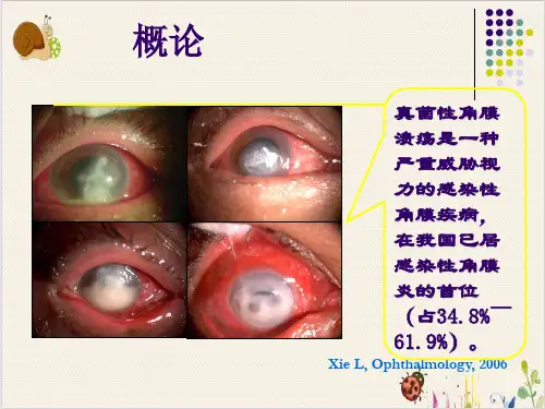 真菌性角膜炎PPT.