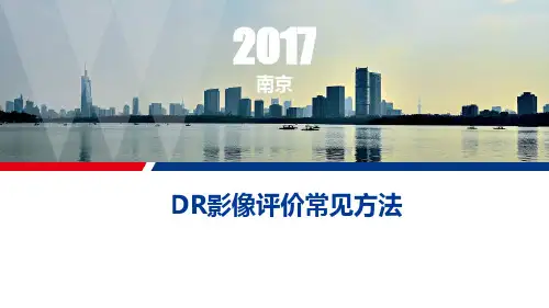 DR影像评价常见方法