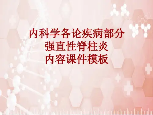 内科学_各论_疾病：强直性脊柱炎_课件模板