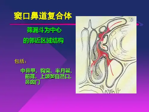 鼻腔鼻窦解剖学异常的种类与鼻窦炎发病的关系及手术处理方式PPT课件