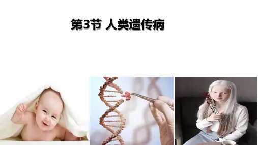 人类遗传病ppt课件