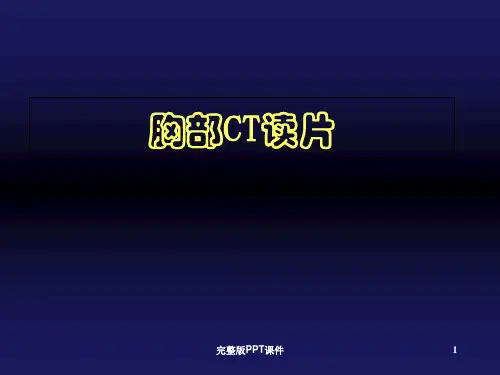 胸部CT读片83066ppt课件