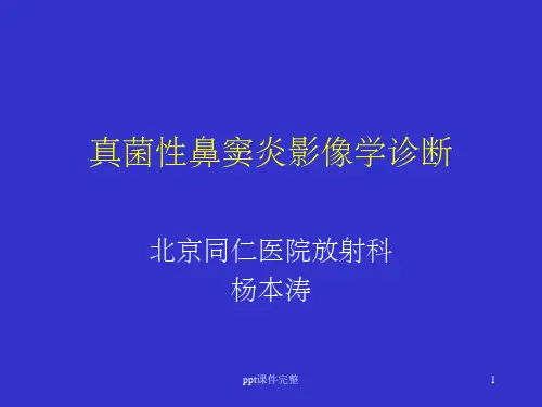 真菌性鼻窦炎影像学诊断ppt课件