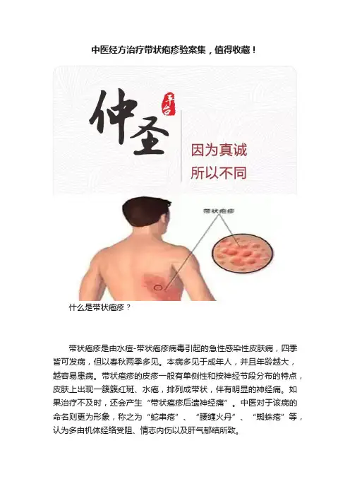 中医经方治疗带状疱疹验案集，值得收藏！