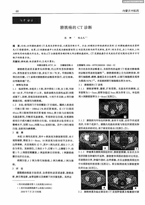 膀胱癌的CT诊断