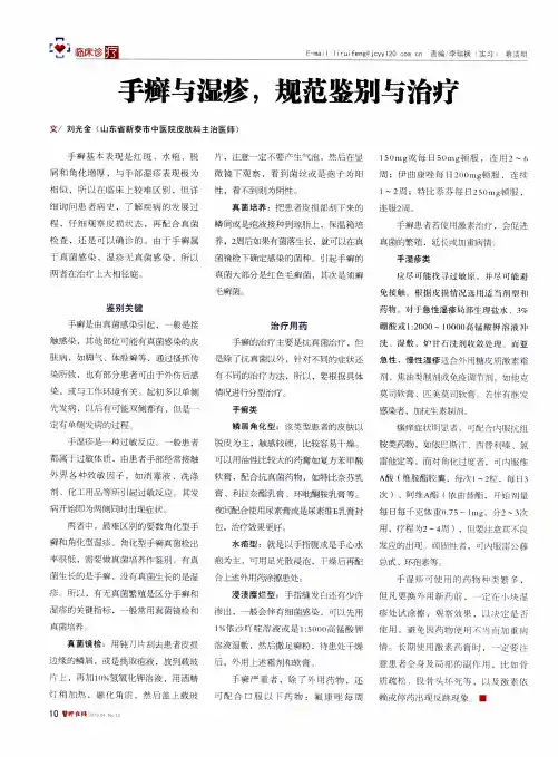 手癣与湿疹,规范鉴别与治疗