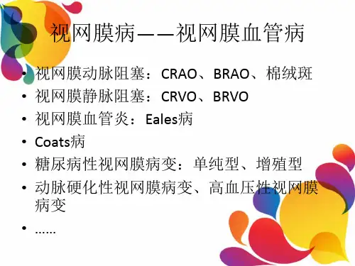眼科常见疾病-PPT课件.ppt