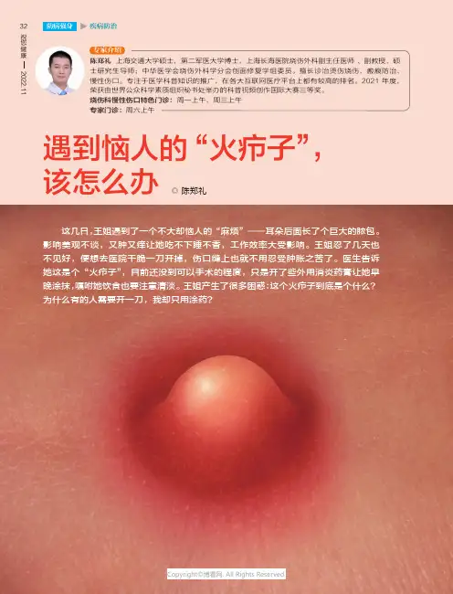 遇到恼人的“火疖子”，该怎么办