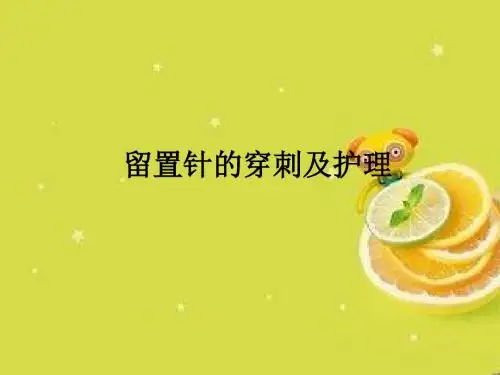留置针的穿刺及护理ppt课件