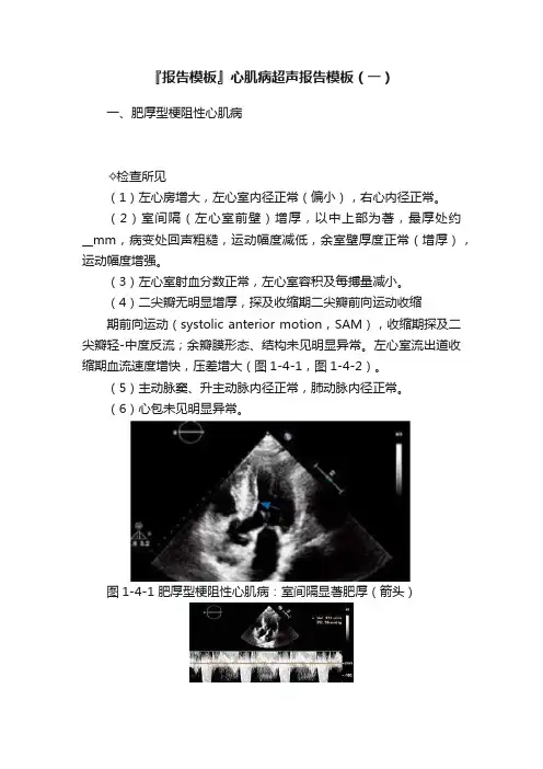 『报告模板』心肌病超声报告模板（一）