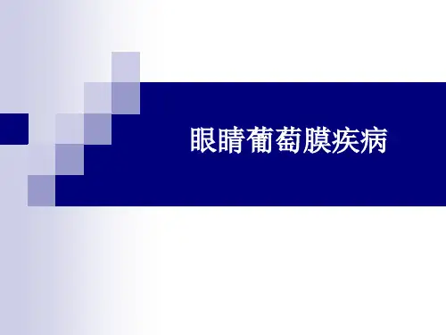 眼睛葡萄膜疾病 ppt课件