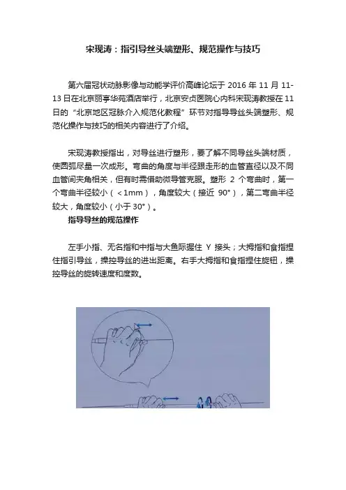 宋现涛：指引导丝头端塑形、规范操作与技巧